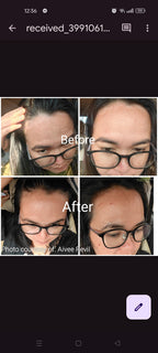 Cool Anti-dandruff Shampoo Bar (for dandruff /itchy scalp)