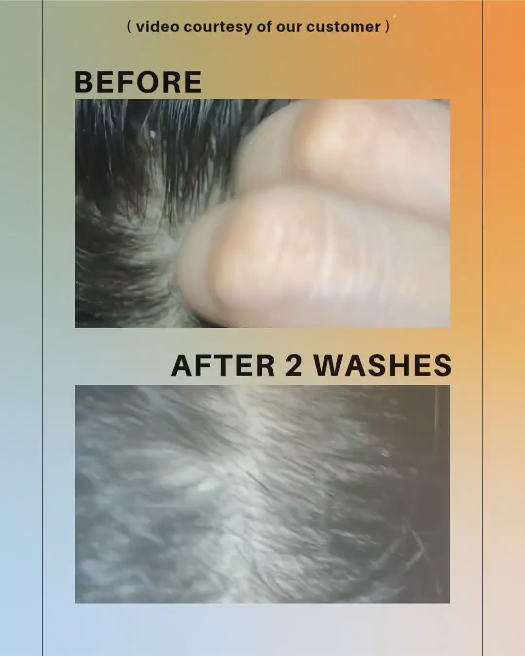 Cool Anti-dandruff Shampoo Bar (for dandruff /itchy scalp)